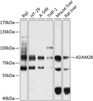 Western blot - ADAM28 Polyclonal Antibody 