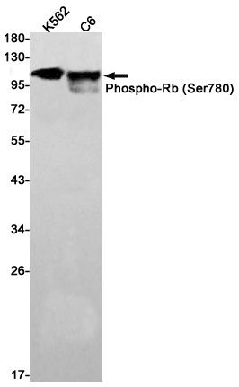 Western blot detection of Phospho-Rb (Ser780) in K562,C6 cell lysates using Phospho-Rb (Ser780) Rabbit pAb(1:1000 diluted).Predicted band size:106kDa.Observed band size:110kDa.
