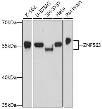 Western blot - ZNF563 Polyclonal Antibody 