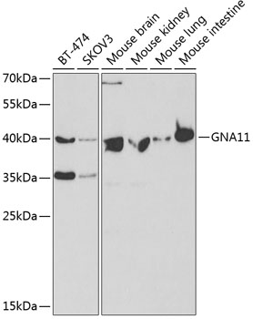 Western blot - GNA11 Polyclonal Antibody 