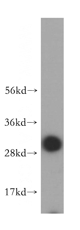 human liver tissue were subjected to SDS PAGE followed by western blot with Catalog No:116808(VTI1B antibody) at dilution of 1:500