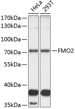 Western blot - FMO2 Polyclonal Antibody 
