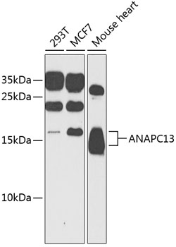 Western blot - ANAPC13 Polyclonal Antibody 