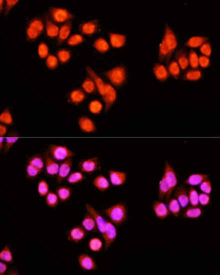 Immunofluorescence - ZNF408 Polyclonal Antibody 