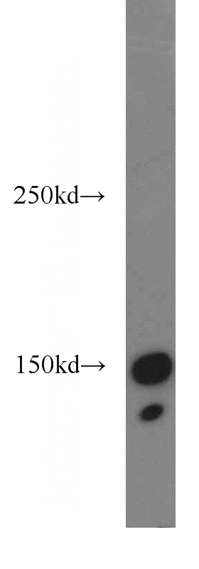 HL-60 cells were subjected to SDS PAGE followed by western blot with Catalog No:110518(FANCD2-phospho antibody) at dilution of 1:200