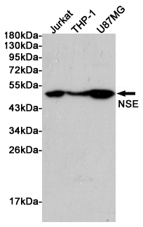 Western blot analysis of extracts from Jurkat, THP-1 and U87MG cells using NSE Rabbit pAb at 1:1000 dilution. Predicted band size: 47kDa. Observed band size: 47kDa.