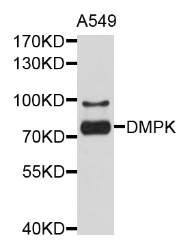 Western blot - DMPK Polyclonal Antibody 