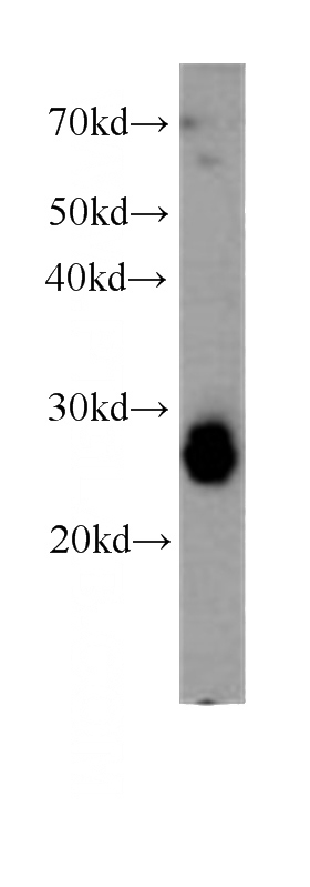 HEK-293 cells were subjected to SDS PAGE followed by western blot with Catalog No:107633(TPI1 antibody) at dilution of 1:500
