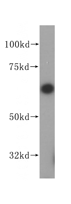 Jurkat cells were subjected to SDS PAGE followed by western blot with Catalog No:108234(ASNS antibody) at dilution of 1:500