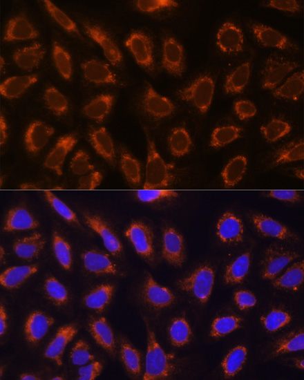 Immunofluorescence - GANAB Polyclonal Antibody 