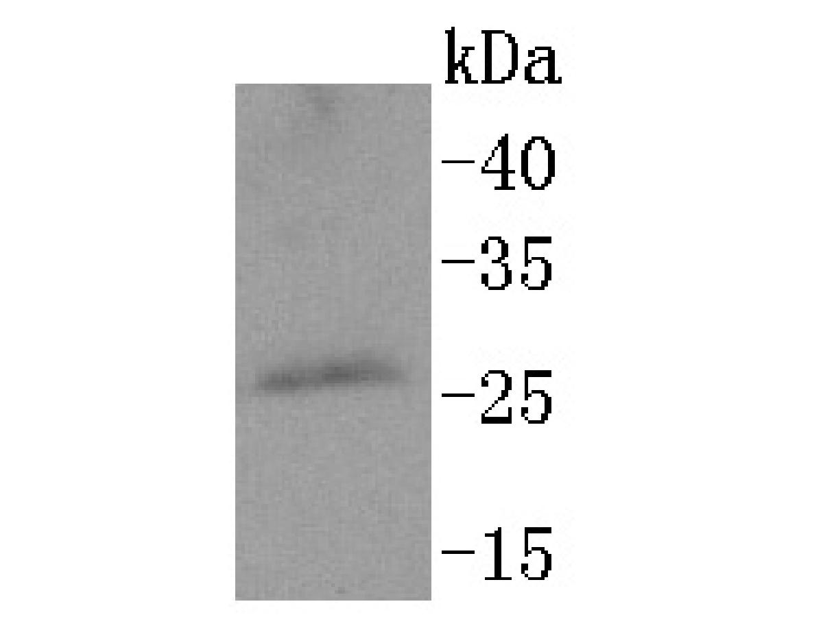 Fig1:; Western blot analysis of PPP1R1A on rat brain tissue lysates. Proteins were transferred to a PVDF membrane and blocked with 5% BSA in PBS for 1 hour at room temperature. The primary antibody ( 1/500) was used in 5% BSA at room temperature for 2 hours. Goat Anti-Rabbit IgG - HRP Secondary Antibody (HA1001) at 1:200,000 dilution was used for 1 hour at room temperature.
