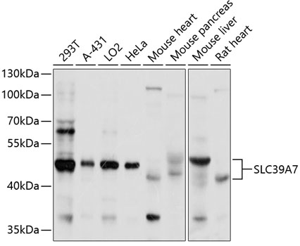 Western blot - SLC39A7 Polyclonal Antibody 