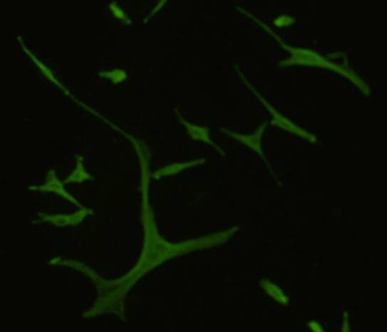 Fig2: Immunofluorescent staining of A172 cells using anti- GPR132 rabbit polyclonal antibody.