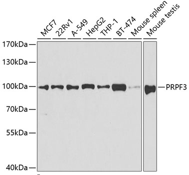 Western blot - PRPF3 Polyclonal Antibody 