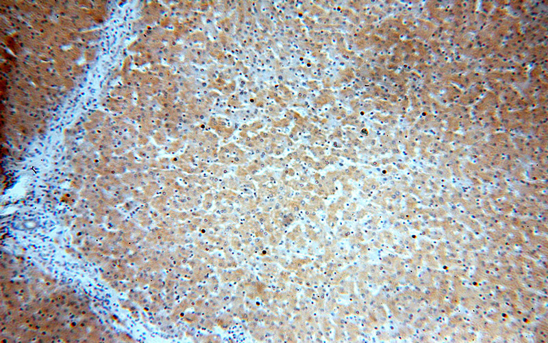 Immunohistochemical of paraffin-embedded human liver using Catalog No:111640(NFKBIA antibody) at dilution of 1:100 (under 10x lens)
