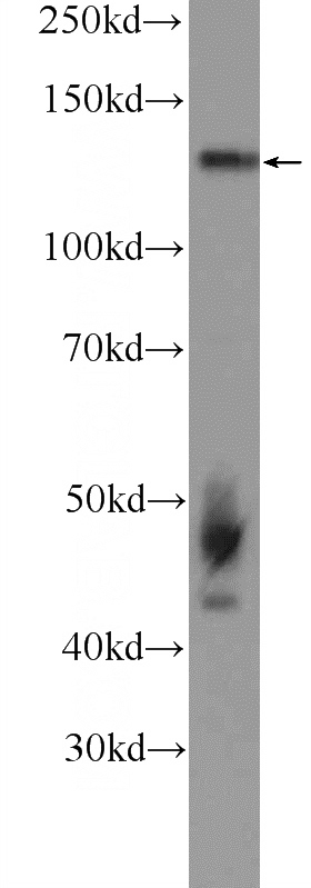 SGC-7901 cells were subjected to SDS PAGE followed by western blot with Catalog No:113295(NOL6 Antibody) at dilution of 1:600