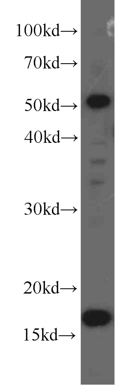 HEK-293 cells were subjected to SDS PAGE followed by western blot with Catalog No:107653(UBC9 antibody) at dilution of 1:1000