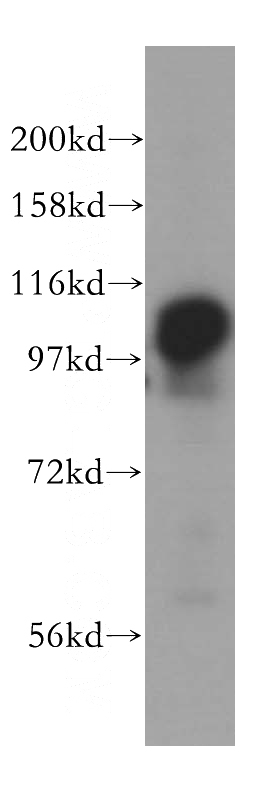 HeLa cells were subjected to SDS PAGE followed by western blot with Catalog No:112867(MSH2 antibody) at dilution of 1:500