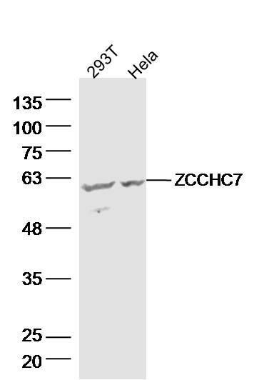 Fig1: Sample:; 293T Cell (Human) Lysate at 40 ug; Hela Cell (Human) Lysate at 40 ug; Primary: Anti-ZCCHC7 at 1/300 dilution; Secondary: IRDye800CW Goat Anti-Rabbit IgG at 1/20000 dilution; Predicted band size: 63 kD; Observed band size: 60 kD