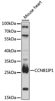Western blot - CCNB1IP1 Polyclonal Antibody 