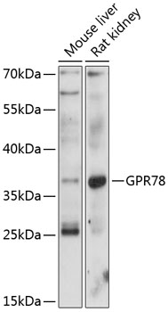 Western blot - GPR78 Polyclonal Antibody 