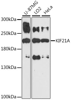 Western blot - KIF21A Polyclonal Antibody 