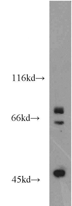 HepG2 cells were subjected to SDS PAGE followed by western blot with Catalog No:116793(VPS52 antibody) at dilution of 1:1000