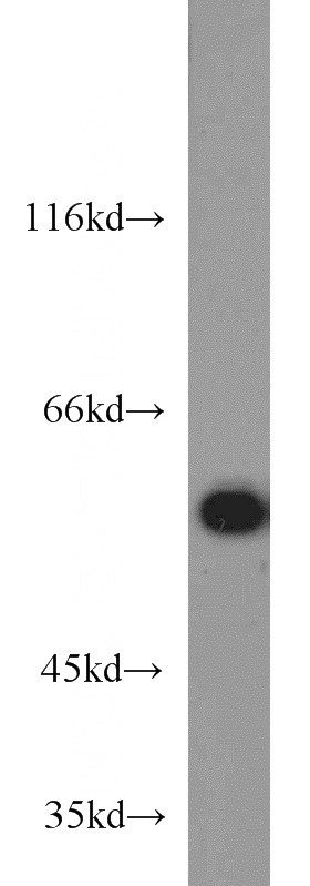 HEK-293 cells were subjected to SDS PAGE followed by western blot with Catalog No:111373(HDAC2 antibody) at dilution of 1:1000