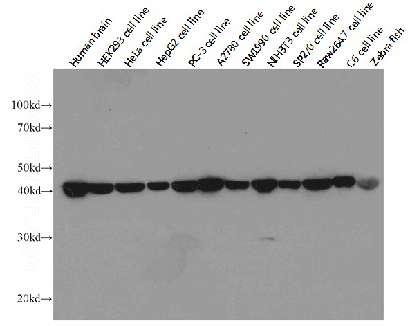 Western blot analysis of beta-actin in various tissues and cell lines using Proteintech antibody Catalog No:117302 at a dilution of 1:20000. (Exposure time: 10 seconds)