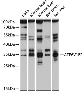 Western blot - ATP6V1E2 Polyclonal Antibody 