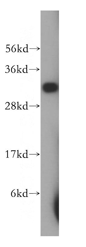 human kidney tissue were subjected to SDS PAGE followed by western blot with Catalog No:113647(PECR antibody) at dilution of 1:400