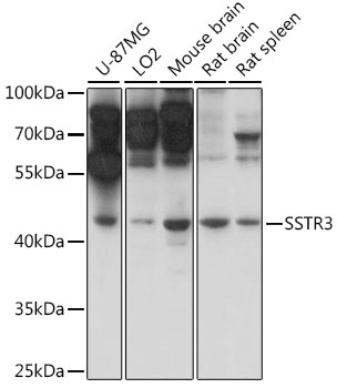 Western blot - SSTR3 Polyclonal Antibody 