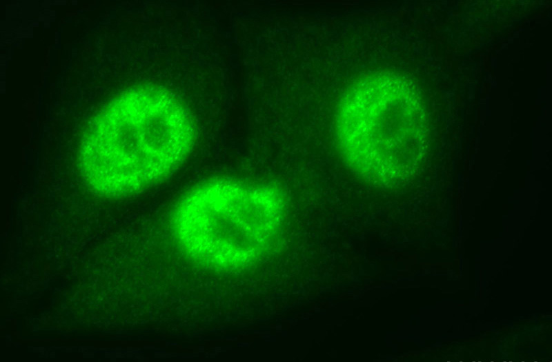 Immunofluorescent analysis of HepG2 cells, using PCNA antibody Catalog No:117336 at 1:50 dilution and FITC-labeled donkey anti-rabbit IgG (green).