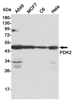 Western blot detection of PDK2 in A549,MCF7,C6 and Hela cell lysates using PDK2 mouse mAb (1:2000 diluted).Predicted band size:46KDa.Observed band size:46KDa.