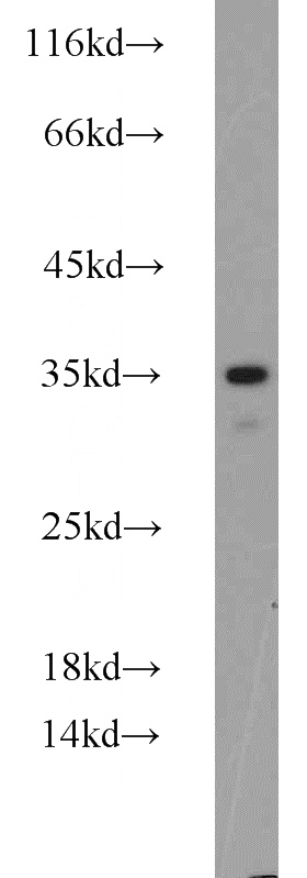 mouse testis tissue were subjected to SDS PAGE followed by western blot with Catalog No:113481(PRKRA antibody) at dilution of 1:800