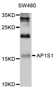 Western blot - AP1S1 Polyclonal Antibody 