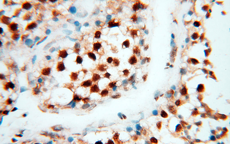 Immunohistochemical of paraffin-embedded human testis using Catalog No:114610(RBM3 antibody) at dilution of 1:50 (under 40x lens)