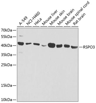 Western blot - RSPO3 Polyclonal Antibody 