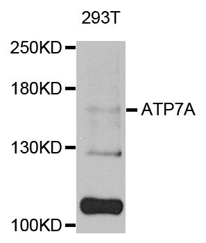 Western blot - ATP7A Polyclonal Antibody 