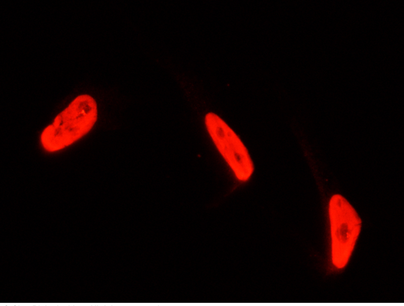 Human PTBP1 Immunofluorescence(IF) 14603