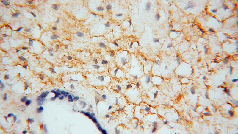 Immunohistochemical of paraffin-embedded human placenta using Catalog No:108539(BTD antibody) at dilution of 1:50 (under 40x lens)