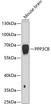 Western blot - PPP3CB Polyclonal Antibody 