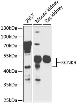 Western blot - KCNK9 Polyclonal Antibody 