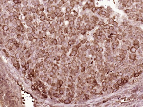 Fig3: Paraformaldehyde-fixed, paraffin embedded (Mouse ovary); Antigen retrieval by boiling in sodium citrate buffer (pH6.0) for 15min; Block endogenous peroxidase by 3% hydrogen peroxide for 20 minutes; Blocking buffer (normal goat serum) at 37℃ for 30min; Antibody incubation with (MTNR1B) Polyclonal Antibody, Unconjugated at 1:400 overnight at 4℃, followed by operating according to SP Kit(Rabbit) (sp-0023) instructionsand DAB staining.