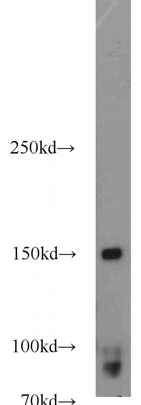 human blood tissue were subjected to SDS PAGE followed by western blot with Catalog No:109043(ITGAX antibody) at dilution of 1:500