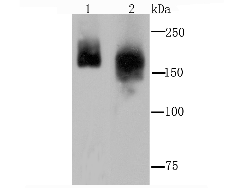Fig1: Western blot analysis of Clathrin heavy chain on Hela (1) and PC-12 (2) cell lysate using anti-Clathrin heavy chain antibody at 1/1,000 dilution.