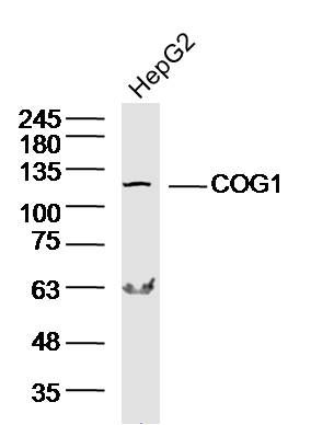 Fig1: Sample: HepG2 Cell (Human) Lysate at 40 ug; Primary: Anti-COG1 at 1/300 dilution; Secondary: IRDye800CW Goat Anti-Rabbit IgG at 1/20000 dilution; Predicted band size: 109 kD; Observed band size: 109 kD