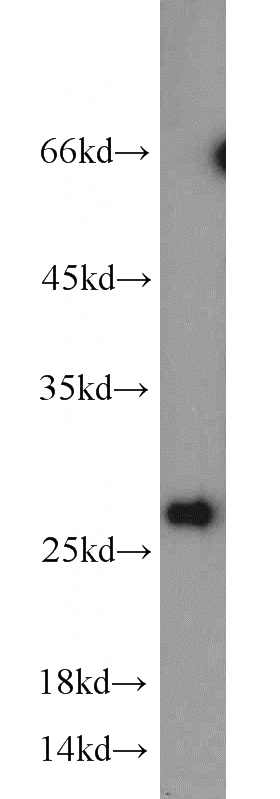 mouse brain tissue were subjected to SDS PAGE followed by western blot with Catalog No:115814(STXBP6 antibody) at dilution of 1:500