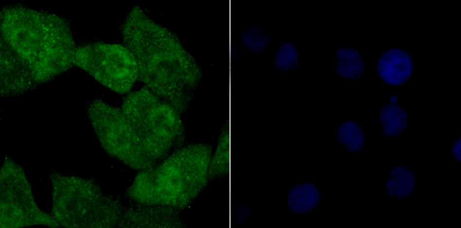Fig3: ICC staining Tle6 in A549 cells (green). The nuclear counter stain is DAPI (blue). Cells were fixed in paraformaldehyde, permeabilised with 0.25% Triton X100/PBS.