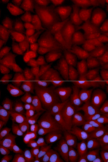 Immunofluorescence - SNCG Polyclonal Antibody 